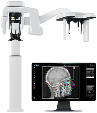 Escáner CBCT junto al monitor con la reconstrucción tridimensional del cráneo