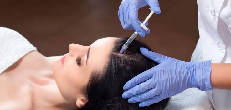 Microinyecciones en el cuero cabelludo durante una mesoterapia capilar